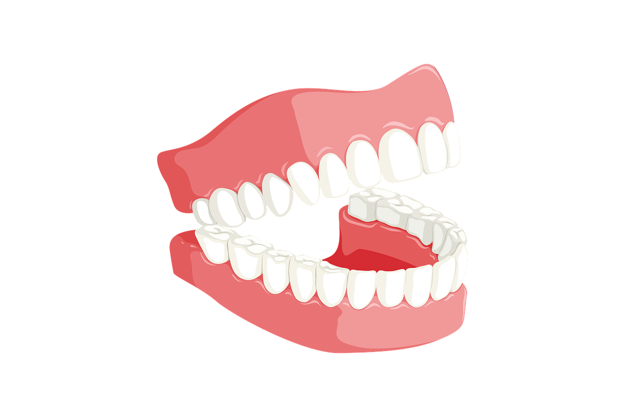 teeth, dentist, mouth-3414722.jpg